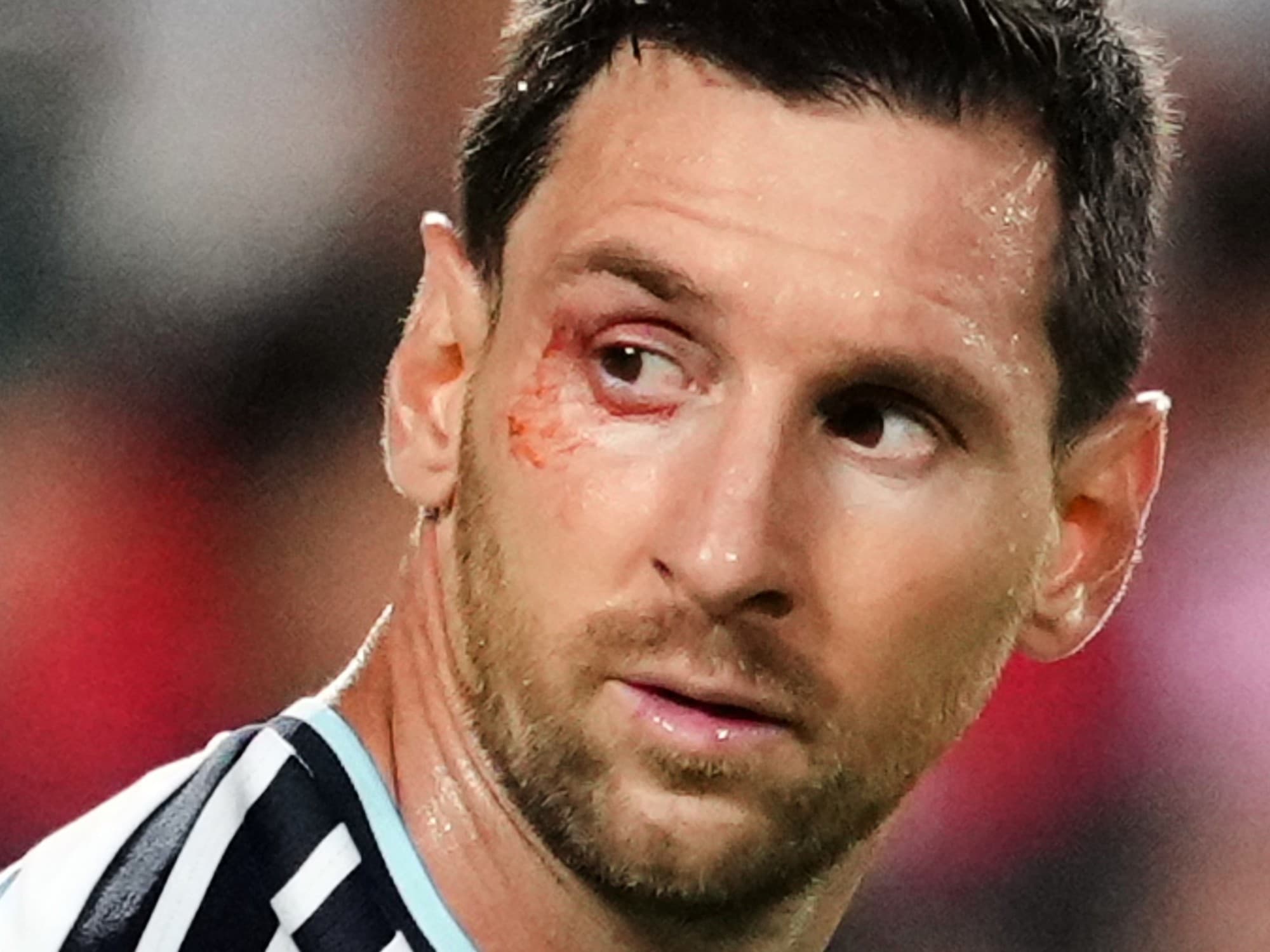 Preocupación en la Selección: el llamativo corte en el ojo de Lionel Messi ante Suiza